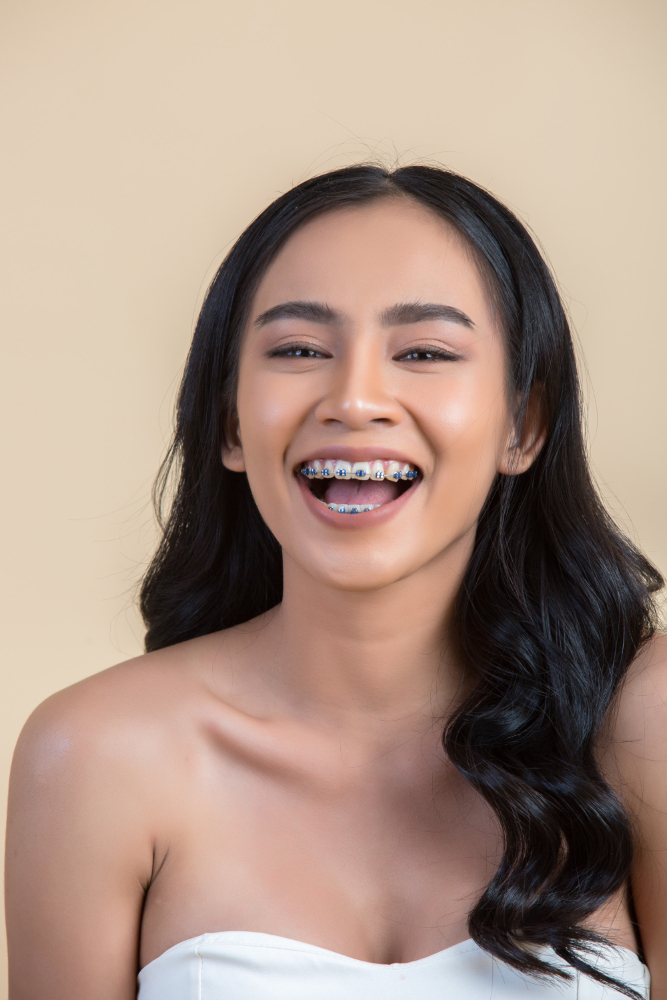 Braces