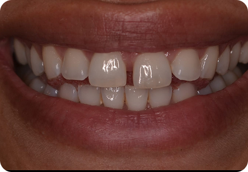 Before treatment