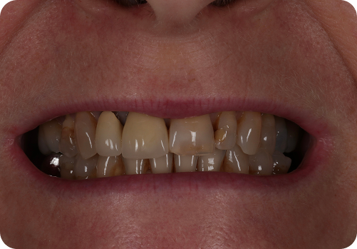 Before treatment
