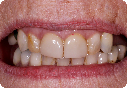 Before treatment
