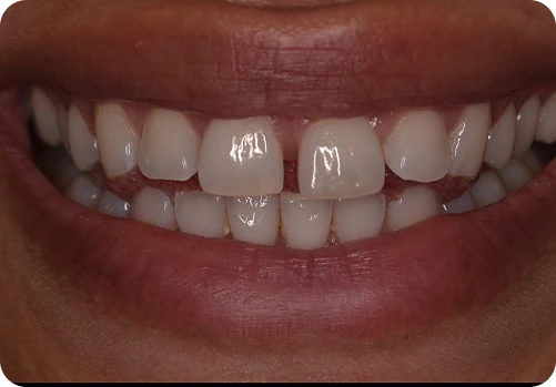 Before treatment