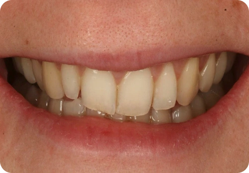 Before treatment