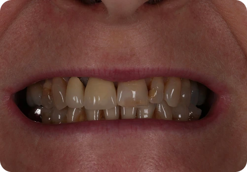 Before treatment